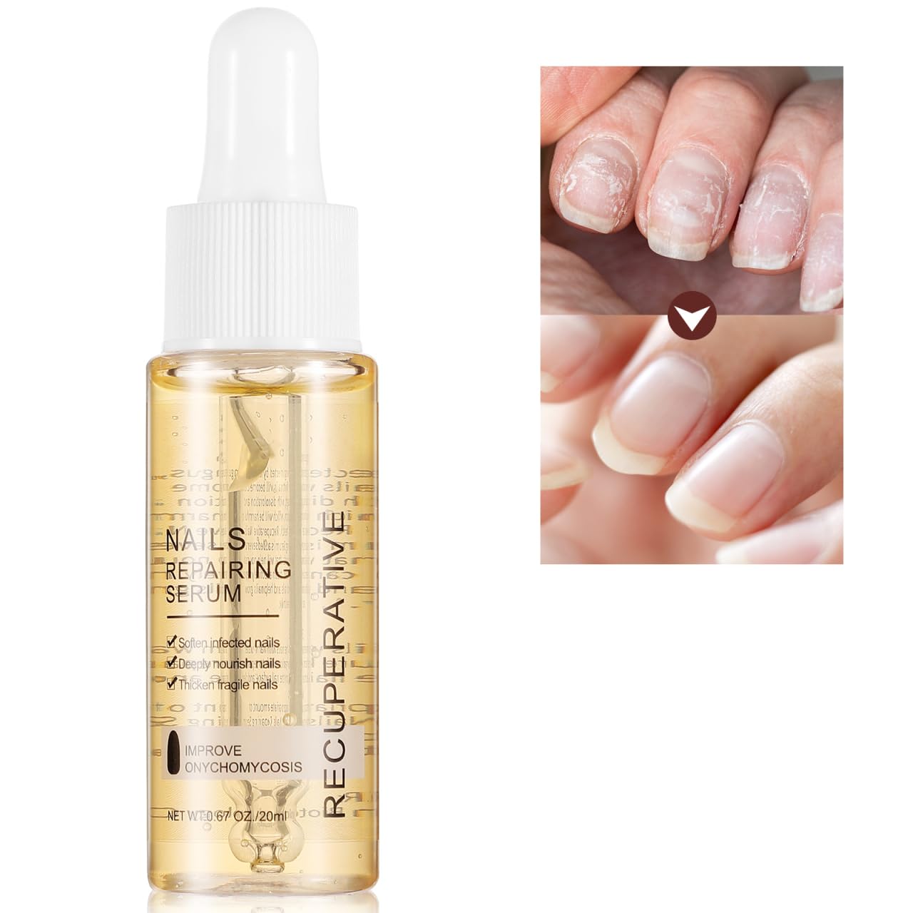[2X1] SERUM ELIMINA HONGOS DE LAS UÑAS