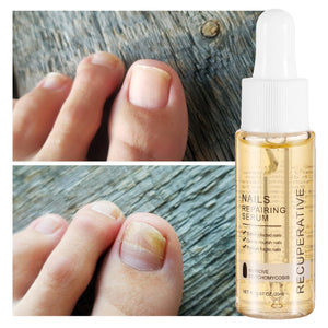 [2X1] SERUM ELIMINA HONGOS DE LAS UÑAS