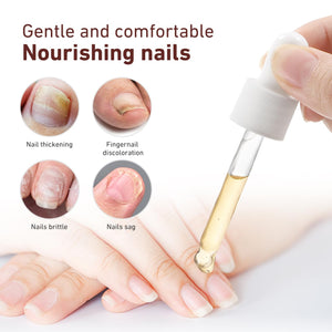 [2X1] SERUM ELIMINA HONGOS DE LAS UÑAS